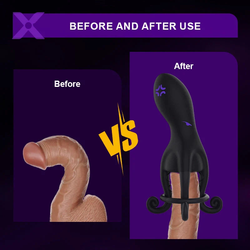 XG11 - 10 Vibration Modes Octopus Tentacle Glans Trainer Masturbator with Full-Wrap Stimulation